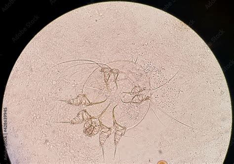 dermatophagoides farinae - calça sufgang